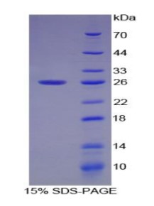 SDS-PAGE SMAD1-656C.jpg